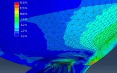 Repetitive strain from eye movement may play a role in glaucoma